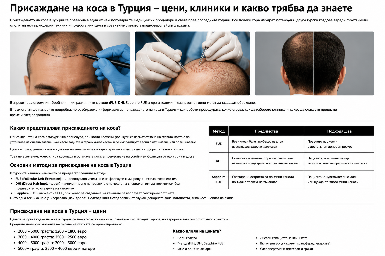 Присаждане на коса в Турция – цени, клиники и какво трябва да знаете